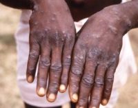 Centre holds high-level review meeting on Monkeypox after reports of fourth case in country