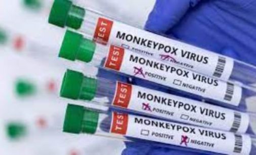 Samples of 5-year-old UP girl collected for monkeypox testing, says official
