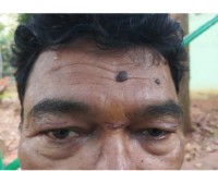 ଚାଇନା ମଞ୍ଜା ସୂତାରେ ପୁଲିସ ଅଧିକାରୀ ଆହତ 