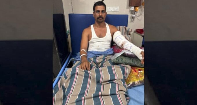 Miracle surgery at Odisha’s Hi-Tech Medical College saves security guard’s arm