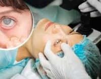 DEBUNKING MYTHS: CATARACT SURGERY & SUMMER