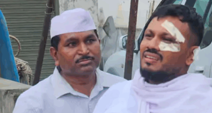 Diu mourns as the only survivor in the Ahmedabad plane crash, Vishwas, bids a final ‘goodbye’ to his brother