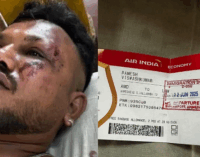 One miracle survivor walks away from site of Air India plane crash in Ahmedabad