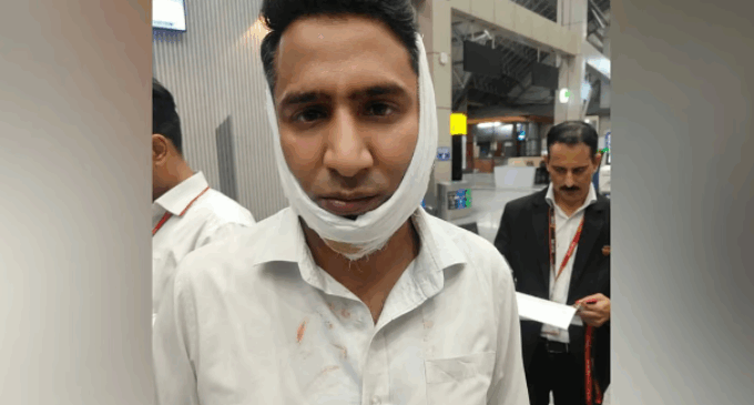 ‘Spinal fracture, jaw injuries’: Army officer assaults SpiceJet staff at Srinagar Airport